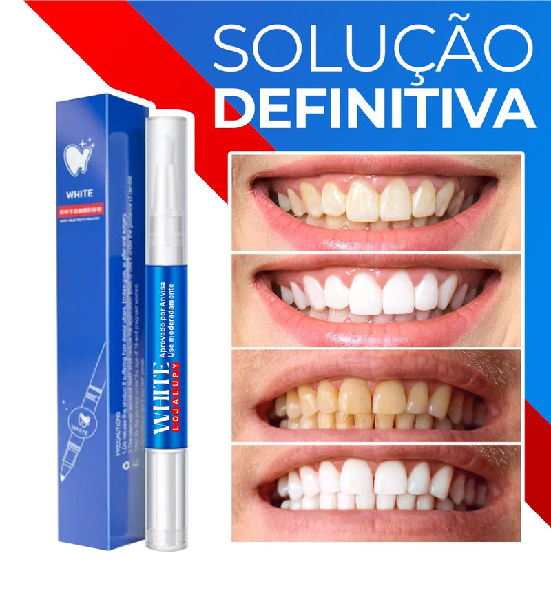 Dentes Brancos e Naturais - TotalWhite® [ÚLTIMO DIA DE FRETE GRÁTIS]